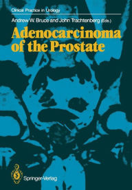 Title: Adenocarcinoma of the Prostate, Author: Andrew W. Bruce