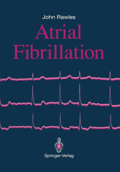 Atrial Fibrillation