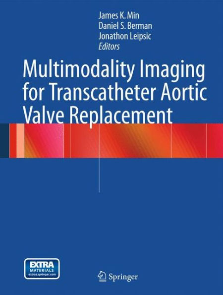 Multimodality Imaging for Transcatheter Aortic Valve Replacement / Edition 1