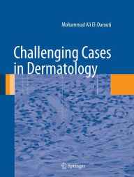 Title: Challenging Cases in Dermatology / Edition 1, Author: Mohammad Ali El-Darouti