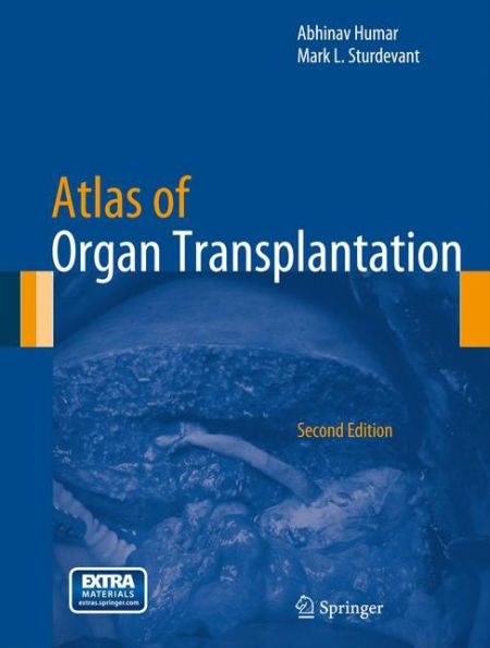 Atlas of Organ Transplantation / Edition 2