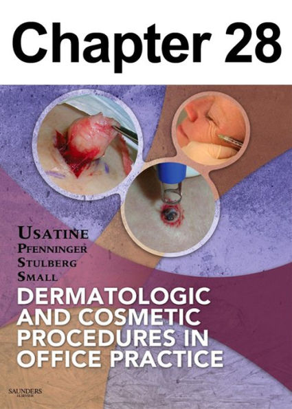 Wrinkle Reduction with Nonablative Lasers: Chapter 28 of Dermatologic and Cosmetic Procedures in Office Practice