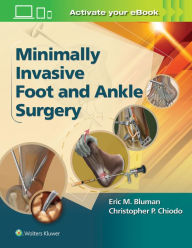 Title: Minimally Invasive Foot & Ankle Surgery, Author: Eric M. Bluman M.D.