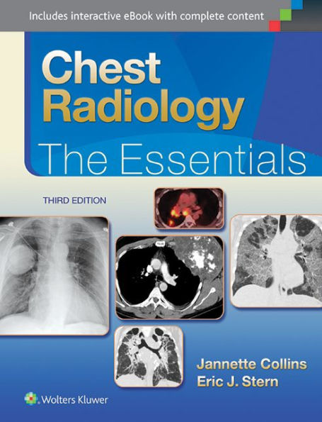 Chest Radiology: The Essentials / Edition 3