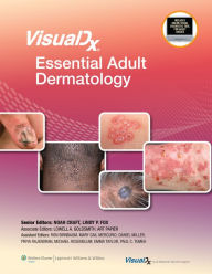 Title: VisualDx: Essential Adult Dermatology, Author: Noah Craft