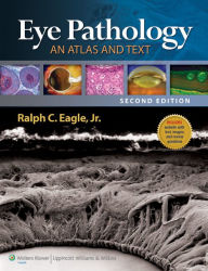 Title: Eye Pathology: An Atlas and Text, Author: Ralph C. Eagle