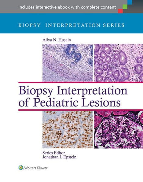 Biopsy Interpretation of Pediatric Lesions / Edition 1