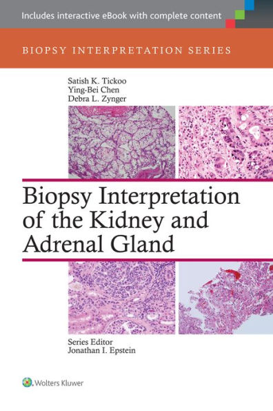 Biopsy Interpretation of the Kidney & Adrenal Gland / Edition 1