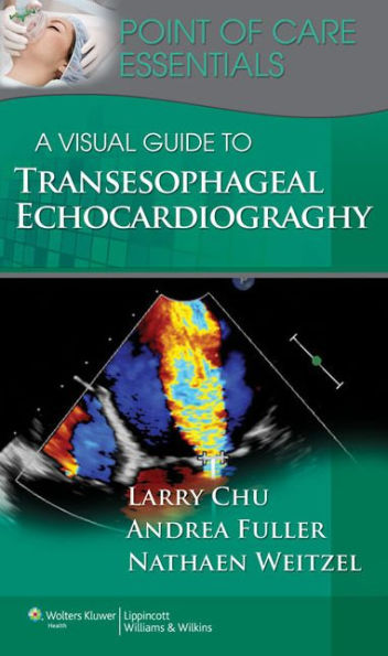 A Visual Guide to Transesophageal Echocardiography