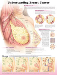 Title: Understanding Breast Cancer 3E Laminated, Author: LWW