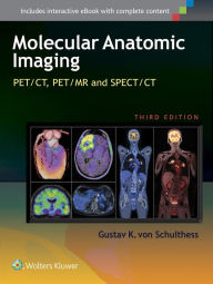 Title: Molecular Anatomic Imaging: PET/CT, PET/MR and SPECT CT / Edition 3, Author: Gustav K. von Schulthess MD