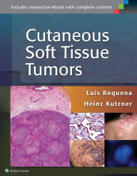 Title: Cutaneous Soft Tissue Tumors, Author: Luis Requena