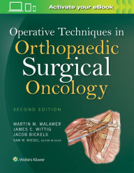 Good books download Operative Techniques in Orthopaedic Surgical Oncology (English Edition) by Martin M. Malawer, James C Wittig 9781451193275