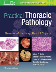 Title: Practical Thoracic Pathology: Diseases of the Lung, Heart, and Thymus / Edition 1, Author: Allen P. Burke MD