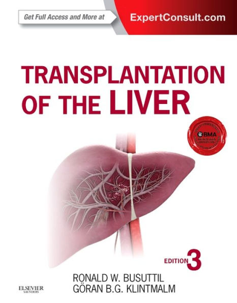 Transplantation of the Liver / Edition 3