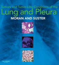 Title: Tumors and Tumor-like Conditions of the Lung and Pleura E-Book, Author: Cesar A. Moran