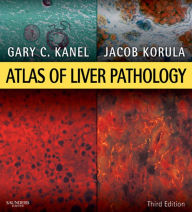Title: Atlas of Liver Pathology E-Book: Expert Consult - Online and Print, Author: Gary C. Kanel MD
