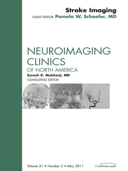 Imaging of Ischemic Stroke, An Issue of Neuroimaging Clinics: Stroke Imaging Update, An Issue of Neuroimaging Clinics