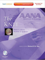 Title: AANA Advanced Arthroscopy: The Knee: Expert Consult: Online, Print and DVD, Author: Robert E. Hunter