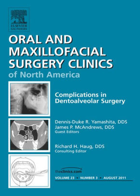 Dento Alveolar Complications An Issue Of Oral And Maxillofacial