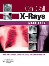 Title: On-Call X-Rays Made Easy E-Book, Author: Iain Au-Yong