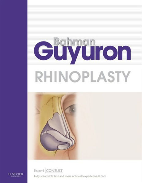 Rhinoplasty E-Book: Expert Consult - Online