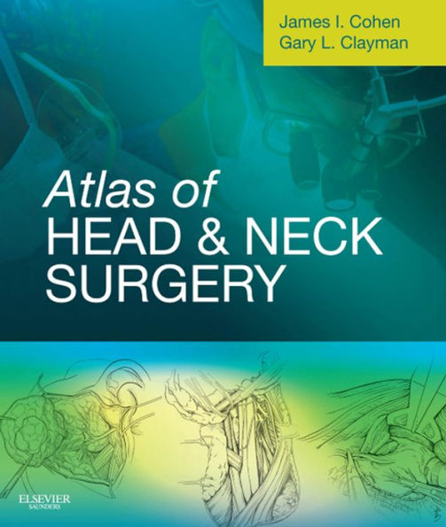 Atlas of Head and Neck Surgery: Expert Consult - Online and Print