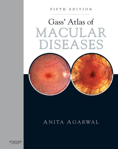 Gass' Atlas of Macular Diseases E-Book: 2-Volume Set - Expert Consult: Online and Print