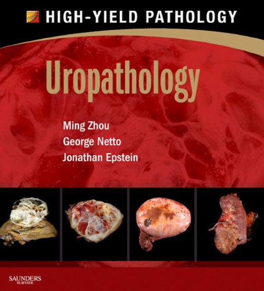 Uropathology E-Book: A Volume in the High Yield Pathology Series