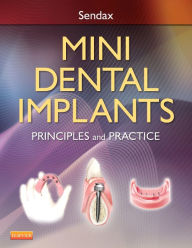 Title: Mini Dental Implants: Principles and Practice, Author: Victor Dr. Sendax