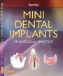 Mini Dental Implants: Principles and Practices