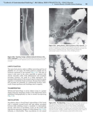 Textbook Of Gastrointestinal Radiology, 2-Volume Set / Edition 4 By ...