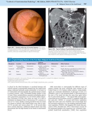 Textbook Of Gastrointestinal Radiology, 2-Volume Set / Edition 4 By ...