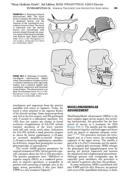 Sleep Medicine Pearls / Edition 3