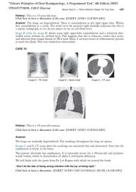 Felson's Principles of Chest Roentgenology, A Programmed Text / Edition ...