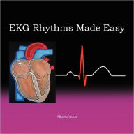 EKG Rhythms Made Easy