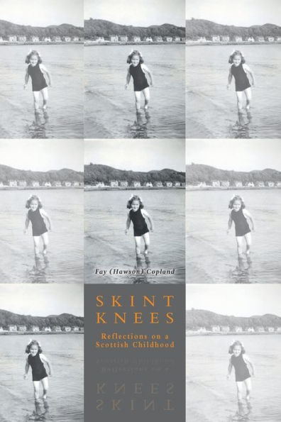 Skint Knees: Reflections on a Scottish Childhood