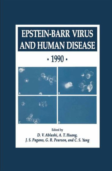 Epstein-Barr Virus and Human Disease · 1990