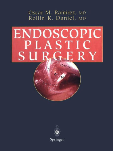 Endoscopic Plastic Surgery / Edition 1