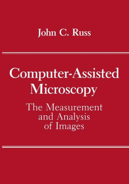 Computer-Assisted Microscopy: The Measurement and Analysis of Images