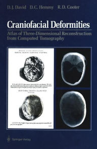 Title: Craniofacial Deformities: Atlas of Three-Dimensional Reconstruction from Computed Tomography, Author: David J. David