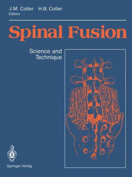 Spinal Fusion: Science and Technique / Edition 1