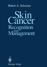 Title: Skin Cancer: Recognition and Management / Edition 1, Author: Robert A. Schwartz