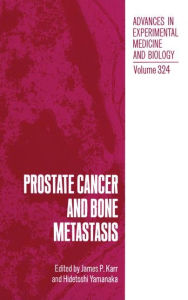 Title: Prostate Cancer and Bone Metastasis, Author: James P. Karr