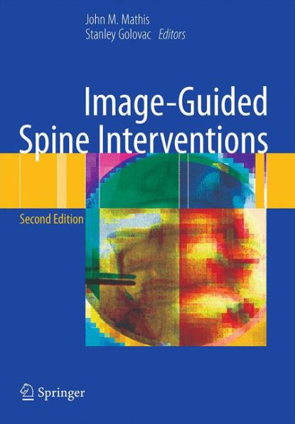 Image-Guided Spine Interventions / Edition 2