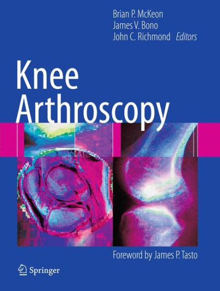 Knee Arthroscopy / Edition 1