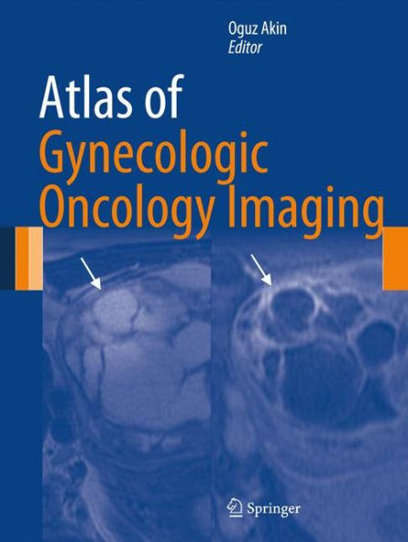 Atlas of Gynecologic Oncology Imaging / Edition 1