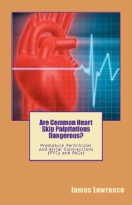 Title: Are Common Heart Skip Palpitations Dangerous?: Premature Ventricular and Atrial Contractions (PVCs and PACs), Author: James M. Lowrance