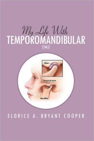 Title: My Life With Temporomandibular (TMJ): Living With TMJ, Author: Elorice A. Bryant Cooper