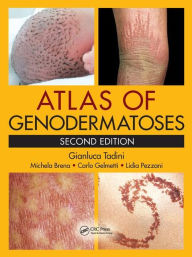 Title: Atlas of Genodermatoses / Edition 2, Author: Gianluca Tadini